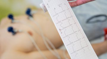 Monitoraggio cardiologico