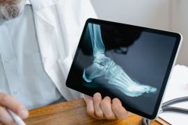 Diagnosi e trattamenti per patologie articolari e muscolo-scheletriche