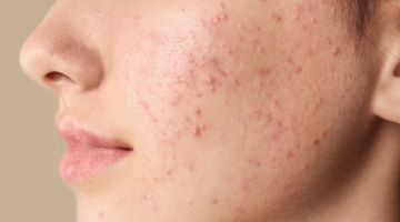 Problemi dermatologici